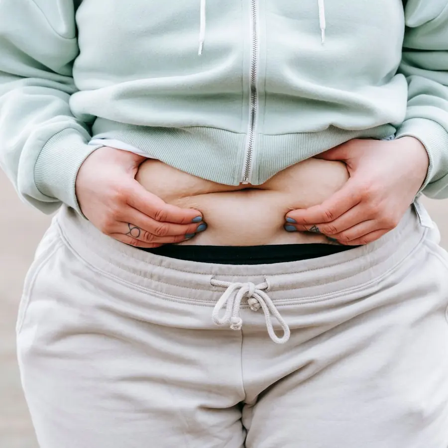 Mãos segurando a pele da barriga
